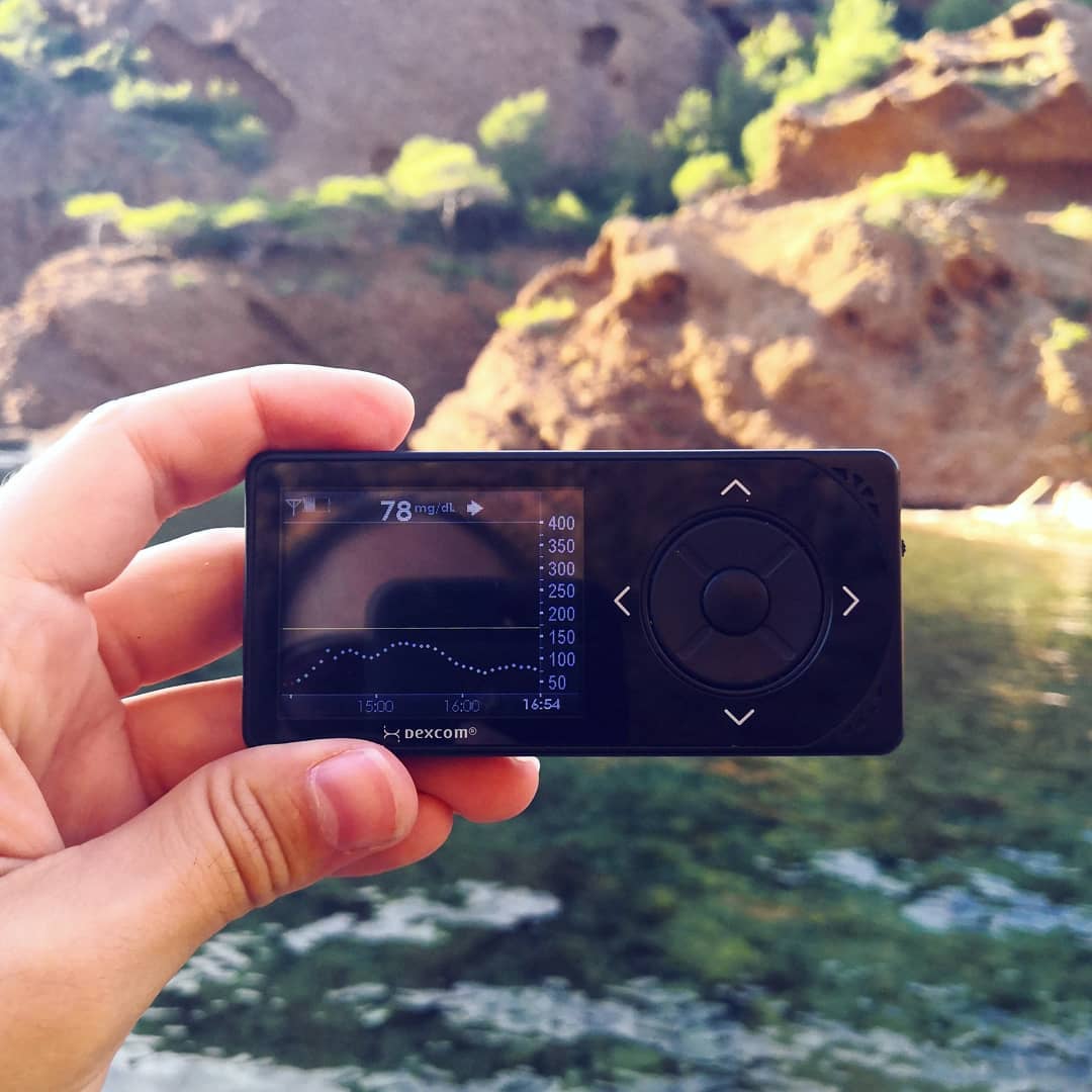 dexcom-calanques